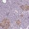 Cripto, FRL-1, Cryptic Family 1 antibody, PA5-59720, Invitrogen Antibodies, Immunohistochemistry paraffin image 