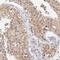 Ubiquitin Conjugating Enzyme E2 E3 antibody, NBP1-86884, Novus Biologicals, Immunohistochemistry paraffin image 