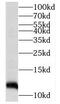 Transmembrane Protein 141 antibody, FNab08753, FineTest, Western Blot image 