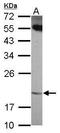 Ankyrin Repeat Domain 39 antibody, GTX120277, GeneTex, Western Blot image 