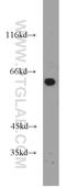 Sterol 26-hydroxylase, mitochondrial antibody, 19195-1-AP, Proteintech Group, Western Blot image 