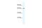 Calcium Voltage-Gated Channel Auxiliary Subunit Beta 2 antibody, GTX47706, GeneTex, Western Blot image 