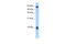 S100 Calcium Binding Protein A3 antibody, 29-693, ProSci, Enzyme Linked Immunosorbent Assay image 