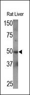 Matrix Metallopeptidase 3 antibody, 250753, Abbiotec, Western Blot image 