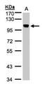Non-SMC Condensin I Complex Subunit H antibody, NBP1-32573, Novus Biologicals, Western Blot image 