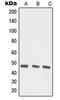 Matrix Metallopeptidase 27 antibody, LS-C353517, Lifespan Biosciences, Western Blot image 