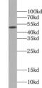 TIMELESS-interacting protein antibody, FNab08716, FineTest, Western Blot image 