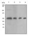 Tubulin Polymerization Promoting Protein antibody, ab92305, Abcam, Western Blot image 