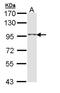 Taste 1 Receptor Member 1 antibody, NBP2-20570, Novus Biologicals, Western Blot image 