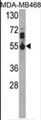 Interleukin 17 Receptor B antibody, AP17497PU-N, Origene, Western Blot image 