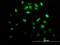 Iroquois Homeobox 3 antibody, H00079191-M05, Novus Biologicals, Immunofluorescence image 