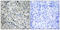 Ubiquitin Specific Peptidase 53 antibody, GTX87956, GeneTex, Immunohistochemistry paraffin image 