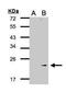 Glutathione Peroxidase 7 antibody, TA308073, Origene, Western Blot image 