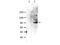 Signal Transducer And Activator Of Transcription 6 antibody, P00523, Boster Biological Technology, Western Blot image 