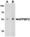 PTPRF Interacting Protein Alpha 1 antibody, orb73558, Biorbyt, Western Blot image 