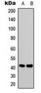 Somatostatin Receptor 1 antibody, LS-C368528, Lifespan Biosciences, Western Blot image 