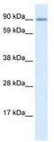 Teashirt Zinc Finger Homeobox 3 antibody, TA331811, Origene, Western Blot image 