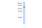 Transcriptional Adaptor 3 antibody, 25-089, ProSci, Western Blot image 