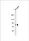 Cell Proliferation Regulating Inhibitor Of Protein Phosphatase 2A antibody, PA5-72334, Invitrogen Antibodies, Western Blot image 