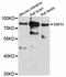Syntaphilin antibody, A12300, ABclonal Technology, Western Blot image 