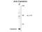 Calbindin 2 antibody, GTX82731, GeneTex, Western Blot image 