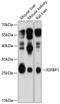 Insulin Like Growth Factor Binding Protein 1 antibody, 13-915, ProSci, Western Blot image 