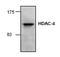 Histone Deacetylase 4 antibody, AP00273PU-N, Origene, Western Blot image 