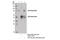 Phosphoinositide-3-Kinase Regulatory Subunit 1 antibody, 13666S, Cell Signaling Technology, Immunoprecipitation image 