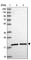 Ubiquitin Conjugating Enzyme E2 G1 antibody, HPA045681, Atlas Antibodies, Western Blot image 