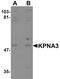 Karyopherin Subunit Alpha 3 antibody, PA5-21035, Invitrogen Antibodies, Western Blot image 