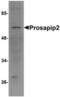 TBK1 Binding Protein 1 antibody, TA306842, Origene, Western Blot image 