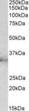 Chloride Intracellular Channel 1 antibody, MBS423193, MyBioSource, Western Blot image 
