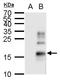 Transforming Growth Factor Alpha antibody, GTX129103, GeneTex, Western Blot image 