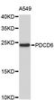 Programmed Cell Death 6 antibody, STJ24926, St John