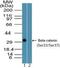 Catenin Beta 1 antibody, NBP2-24456, Novus Biologicals, Western Blot image 