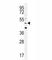 Corticotropin Releasing Hormone Receptor 2 antibody, F40094-0.4ML, NSJ Bioreagents, Western Blot image 