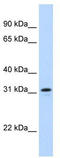 mNIFK antibody, TA343954, Origene, Western Blot image 