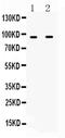 Interferon Gamma Receptor 1 antibody, PA5-79442, Invitrogen Antibodies, Western Blot image 