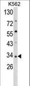 Secreted Frizzled Related Protein 5 antibody, LS-C169018, Lifespan Biosciences, Western Blot image 