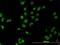 Mesenchyme Homeobox 2 antibody, H00004223-M03, Novus Biologicals, Immunocytochemistry image 