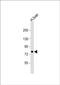 Propionyl-CoA Carboxylase Subunit Alpha antibody, PA5-71678, Invitrogen Antibodies, Western Blot image 