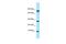 Putative gametogenetin-binding protein 1 antibody, A15688, Boster Biological Technology, Western Blot image 