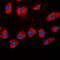 Adducin 2 antibody, LS-C413165, Lifespan Biosciences, Immunofluorescence image 