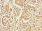 STT3 Oligosaccharyltransferase Complex Catalytic Subunit A antibody, LS-C396711, Lifespan Biosciences, Immunohistochemistry paraffin image 