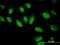 Cytidine/Uridine Monophosphate Kinase 1 antibody, H00051727-M03, Novus Biologicals, Immunocytochemistry image 