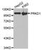 Protein Kinase D1 antibody, STJ29782, St John