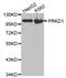 Serine/threonine-protein kinase D1 antibody, STJ29782, St John