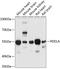 Phosphodiesterase 1A antibody, A06723, Boster Biological Technology, Western Blot image 