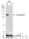 Tropomyosin 3 antibody, GTX113568, GeneTex, Western Blot image 