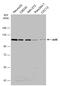 Aryl Hydrocarbon Receptor antibody, GTX129013, GeneTex, Western Blot image 